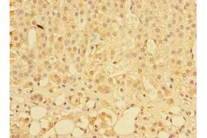 Immunohistochemistry of paraffin-embedded human adrenal gland tissue using ABIN7163662 at dilution of 1:100 (C10orf81 antibody  (AA 181-462))