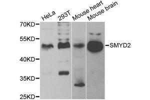 Western blot analysis of extracts of various cell lines, using SMYD2 antibody (ABIN5973871) at 1/1000 dilution. (SMYD2A antibody)