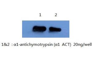 Western Blotting (WB) image for anti-serpin Peptidase Inhibitor, Clade A (Alpha-1 Antiproteinase, Antitrypsin), Member 3 (SERPINA3) antibody (ABIN1105306)