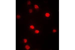 Immunofluorescent analysis of DNMT3B staining in A549 cells. (DNMT3B antibody  (N-Term))