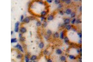 IHC-P analysis of Kidney tissue, with DAB staining. (desert Hedgehog antibody  (AA 241-383))