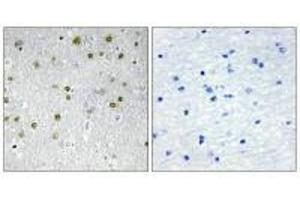 Immunohistochemistry analysis of paraffin-embedded human brain tissue, using NRIP2 antibody. (NRIP2 antibody  (N-Term))