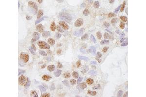 anti-DEAH (Asp-Glu-Ala-His) Box Polypeptide 38 (DHX38) (AA 1150-1200) antibody
