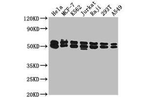 Western Blot Positive WB detected in: Hela whole cell lysate, MCF-7 whole cell lysate, K562 whole cell lysate, Jurkat whole cell lysate, Raji whole cell lysate, 293T whole cell lysate, A549 whole cell lysate All lanes: DNAJA3 antibody at 1:2000 Secondary Goat polyclonal to rabbit IgG at 1/50000 dilution Predicted band size: 53, 50, 34 kDa Observed band size: 53 kDa (DNAJA3 antibody  (AA 86-184))