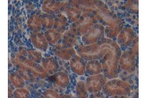 Immunohistochemistry (IHC) image for anti-Adenomatous Polyposis Coli (APC) (AA 2636-2845) antibody (ABIN7439342)