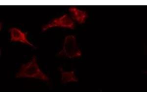 ABIN6275453 staining HuvEc cells by IF/ICC. (IQGAP3 antibody  (N-Term))