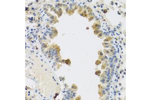 Immunohistochemistry of paraffin-embedded mouse lung using RSPO1 antibody at dilution of 1:100 (40x lens). (RSPO1 antibody)