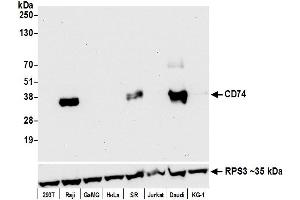 Western Blotting (WB) image for anti-HLA-DR-gamma (CD74) antibody (ABIN7449435) (CD74 antibody)