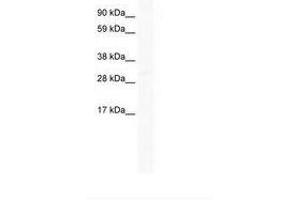 Image no. 1 for anti-Homeobox C6 (HOXC6) (C-Term) antibody (ABIN6736049) (Homeobox C6 antibody  (C-Term))