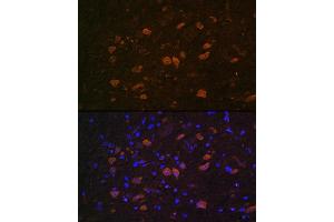 Immunofluorescence (IF) image for anti-ELAV (Embryonic Lethal, Abnormal Vision, Drosophila)-Like 4 (Hu Antigen D) (ELAVL4) (AA 1-366) antibody (ABIN7266914)
