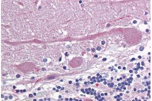 Human Brain, Cerebellum: Formalin-Fixed, Paraffin-Embedded (FFPE) (Glutamate Receptor 3 antibody  (N-Term))