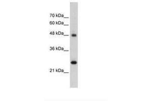Image no. 1 for anti-Chromogranin A (CHGA) (AA 51-100) antibody (ABIN203488) (Chromogranin A antibody  (AA 51-100))