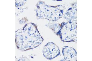 Immunohistochemistry of paraffin-embedded human placenta using KISS1 antibody (ABIN3017121, ABIN3017122, ABIN1680598 and ABIN6219966) at dilution of 1:200 (40x lens). (KISS1 antibody)