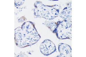 Immunohistochemistry of paraffin-embedded human placenta using KISS1 antibody (ABIN3017121, ABIN3017122, ABIN1680598 and ABIN6219966) at dilution of 1:200 (40x lens).