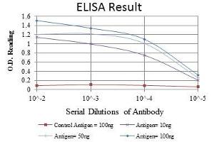 Red: Control Antigen (100 ng), Purple: Antigen (10 ng), Green: Antigen (50 ng), Blue: Antigen (100 ng), (Crk antibody)