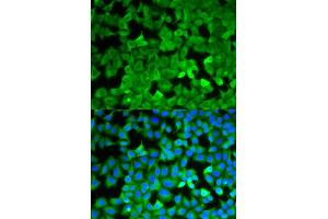 Immunofluorescence (IF) image for anti-Asparagine Synthetase (ASNS) antibody (ABIN1876738) (Asparagine Synthetase antibody)