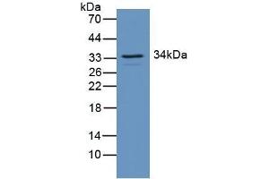 Detection of RGS4 in Mouse Brain Tissue using Polyclonal Antibody to Regulator Of G Protein Signaling 4 (RGS4) (RGS4 antibody  (AA 38-205))