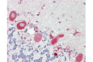 Anti-TNFRSF21 / DR6 antibody IHC staining of human brain, cerebellum. (TNFRSF21 antibody  (AA 356-385))