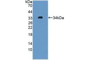 Detection of Recombinant OIT3, Rat using Polyclonal Antibody to Oncoprotein Induced Transcript 3 (OIT3) (OIT3 antibody  (AA 251-524))