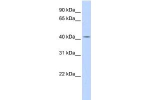 WB Suggested Anti-DHDDS Antibody Titration:  0.