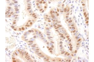 anti-Rad6 (N-Term) antibody