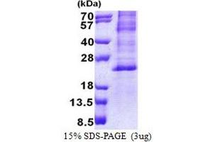 SDS-PAGE (SDS) image for Hairy and Enhancer of Split 2 (HES2) (AA 1-173) protein (His tag) (ABIN5778575) (HES2 Protein (AA 1-173) (His tag))