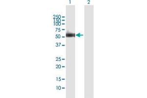 Western Blot analysis of XRCC4 expression in transfected 293T cell line by XRCC4 MaxPab polyclonal antibody. (XRCC4 antibody  (AA 1-336))