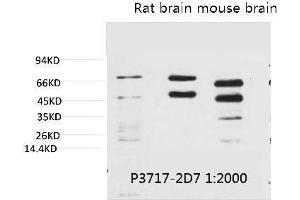 Western blot analysis of 1) Hela, 2) Rat Brain Tissue, 3) Mouse Brain Tissue with Phosphoserine Mouse mAb diluted at 1:2000. (Phosphoserine antibody)