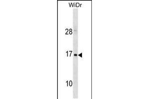 Western blot analysis in WiDr cell line lysates (35ug/lane). (HBZ antibody  (C-Term))