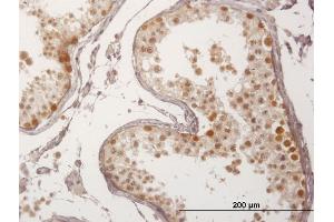 Immunoperoxidase of purified MaxPab antibody to FBXO7 on formalin-fixed paraffin-embedded human testis.