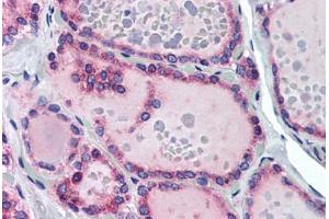 Human Thyroid (formalin-fixed, paraffin-embedded) stained with TRHR antibody ABIN290227 at 10 ug/ml followed by biotinylated goat anti-rabbit IgG secondary antibody ABIN481713, alkaline phosphatase-streptavidin and chromogen. (TRHR antibody  (AA 350-400))
