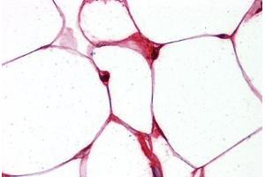 Adipocytes, Human: Formalin-Fixed, Paraffin-Embedded (FFPE) (FABP4 antibody  (Tyr20))