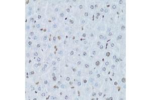 Immunohistochemistry of paraffin-embedded mouse liver using HNF4A Antibody (ABIN5971111) at dilution of 1/100 (40x lens). (HNF4A antibody)