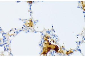 Immunohistochemistry of paraffin-embedded Mouse lung using CTRB1 Polyclonal Antibody at dilution of 1:100 (40x lens). (CTRB1 antibody)