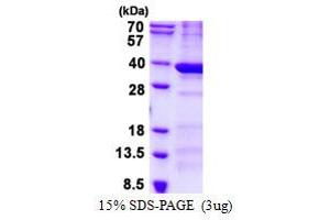 BCDIN3 Domain Containing (BCDIN3D) (AA 1-292) protein (His tag)