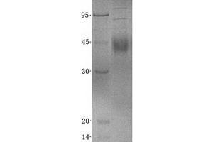 Validation with Western Blot (IL20RA Protein (His tag))