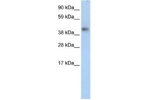 WB Suggested Anti-ZNF620 Antibody Titration: 2. (ZNF620 antibody  (Middle Region))