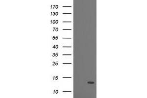 HEK293T cells were transfected with the pCMV6-ENTRY control (Left lane) or pCMV6-ENTRY PDE6G (Right lane) cDNA for 48 hrs and lysed. (PDE6G antibody)