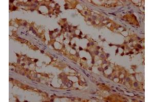 IHC image of ABIN7139968 diluted at 1:200 and staining in paraffin-embedded human testis tissue performed on a Leica BondTM system.