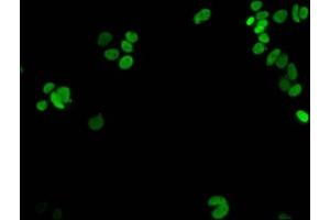 Immunofluorescent analysis of MCF-7 cells using ABIN7139274 at dilution of 1:100 and Alexa Fluor 488-congugated AffiniPure Goat Anti-Rabbit IgG(H+L) (HIST1H1E antibody  (2meLys16))