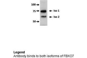 FBXO7 antibody - middle region  validated by WB using U2OS cells at 0.