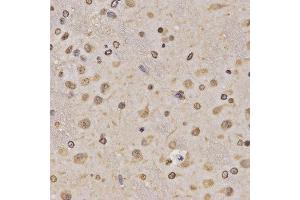 Immunohistochemistry of paraffin-embedded rat brain tissue using H3K36me1 antibody at dilution of 1:200 (x400 lens). (Histone 3 antibody  (H3K36me))