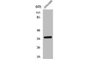 Western Blot analysis of COLO205 cells using AASD-PPT Polyclonal Antibody (AASDHPPT antibody  (N-Term))