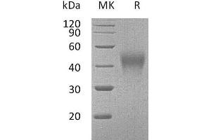 Western Blotting (WB) image for Hepatitis A Virus Cellular Receptor 2 (TIM 3) (AA 20-193) protein (His tag) (ABIN7320694) (TIM3 Protein (AA 20-193) (His tag))