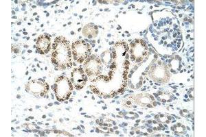 Image no. 2 for anti-Lysine (K)-Specific Demethylase 4D (KDM4D) (C-Term) antibody (ABIN6736292) (JMJD2D antibody  (C-Term))