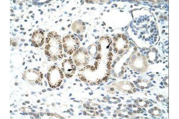 JMJD2D antibody  (C-Term)