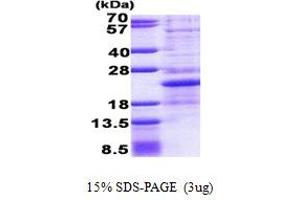 SDS-PAGE (SDS) image for Nescient Helix Loop Helix 1 (NHLH1) (AA 1-133) protein (His tag) (ABIN6387236)