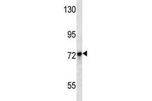 KEAP1 antibody western blot analysis in MDA-MB231 lysate. (KEAP1 antibody  (AA 422-449))