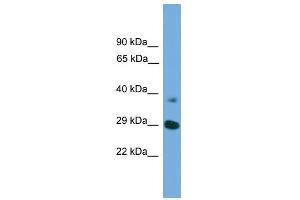 WB Suggested Anti-ATG16L1  Antibody Titration: 0. (ATG16L1 antibody  (Middle Region))