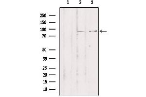 Western blot analysis of extracts from various samples, using ZNF148 Antibody. (ZNF148 antibody  (N-Term))